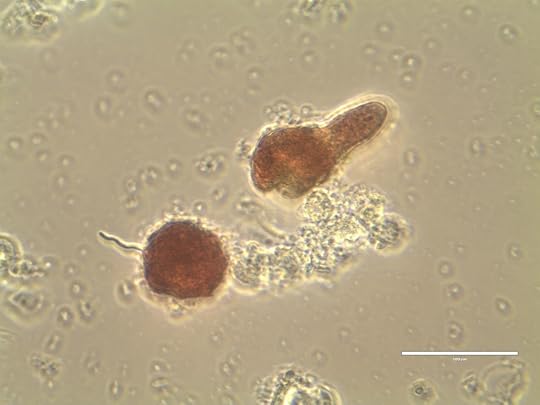 Microscopic mature female gametophyte (left) of the red seaweed Palmaria palmata (dulse) with trichogyne filament visible on the left. On the upper right, a young male gametophyte just starting to elongate. The scale bar at the bottom right represents 0.1 mm (photo credit: Constanza Chianale).