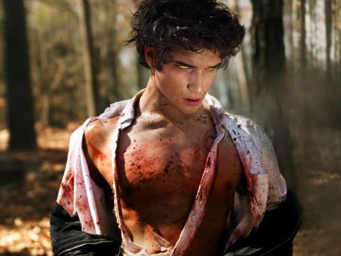 The latest reboot of Teen Wolf. This ain't Michael J. Fox.