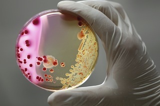 Petri dish