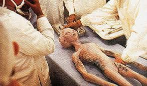 Alien autopsy
