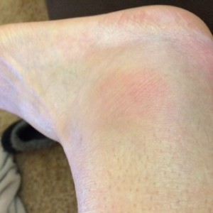 ankle