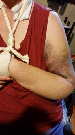 Mom's arm from the front