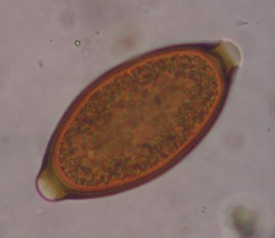 Whipworm egg.