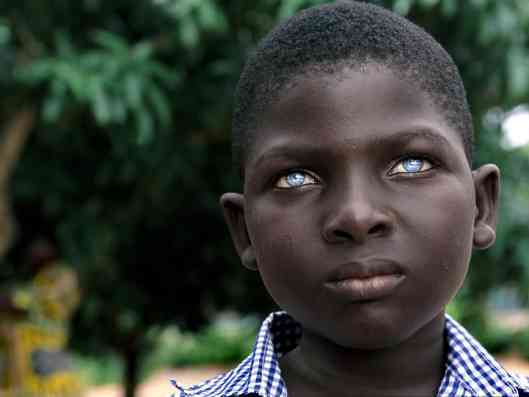 Brenam Brenam Gatien Kebalou is deaf but he is lucky. Rather than abandonning him, his single mother struggles to keep him enrolled in one of four deaf schools in Togo, West Africa. The stigma of a handicap leads many families to abandon their 'different' children, only to become mute beggars on the busy streets of large cities.