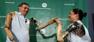 Prosthetic limbs operated by thought - the result of nerve rewiring