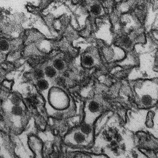 Transmission electron micrograph of the Zika virus. Public domain via Wikimedia Commons.