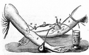 transfusion-jpeg-300x186