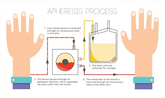 ApheresisProcess_Infographic