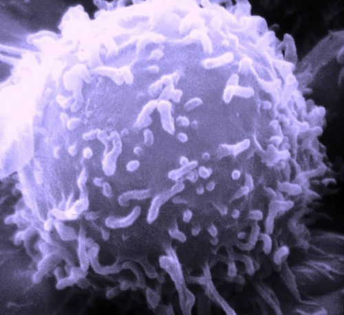 SEM_Lymphocyte.jpg