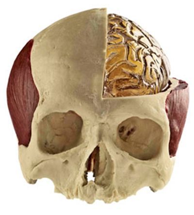 MARTYN brain and skull