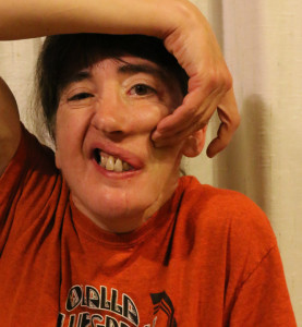 facial reconstructive surgery