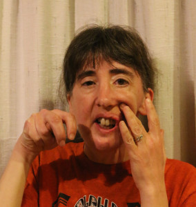 Facial reconstructive surgery