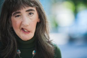 Facial Reconstructive surgery