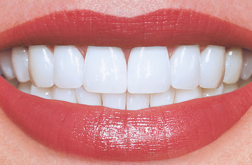 dentes