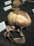 Craven Street Bones