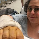 Still totally drugged and painfree. It doesn't last long.