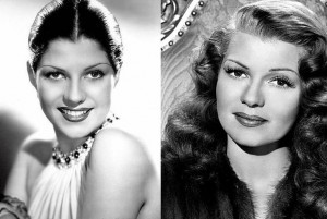 Rita Hayworth before-after-hairline-electrolysis