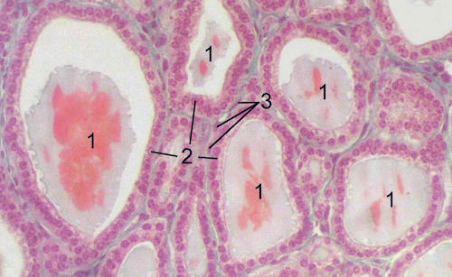Thyoid-histology.jpg