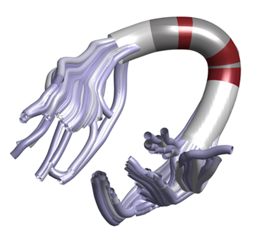 Dyslexlia blog image 2
