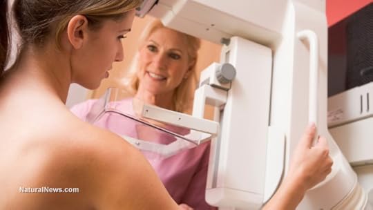 Mammography