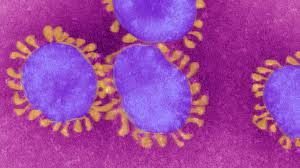 SARS like virus