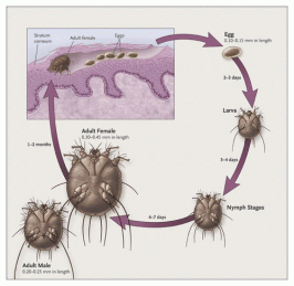 scabies Ivermectin NEJM