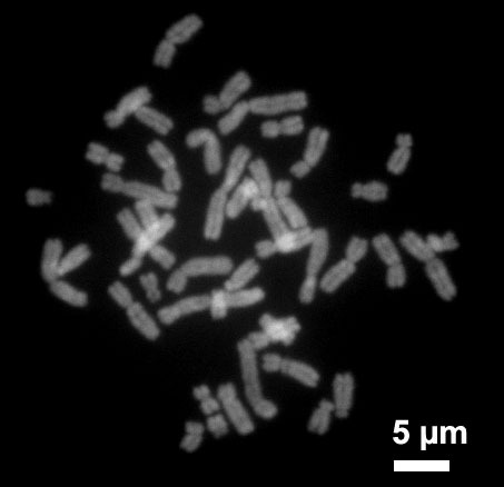 HumanChromosomesChromomycinA3.jpg