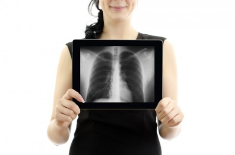 Woman holding tablet pc. Conept: X-ray with lungs. Isolated on white.