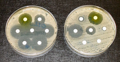 superbug.JPG