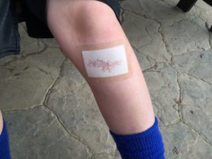 leg wound
