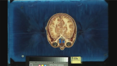 Brain scan, a still from Atomic by Mark Cousins