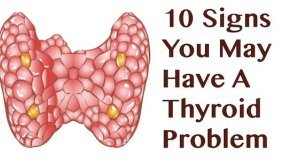 Low thyroid conditon