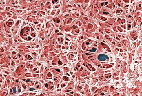Lyme Disease Borrellia