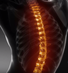 easiest ways to cure a stiff neck - spine image - survive travel