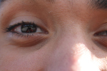 Darius' face (3)