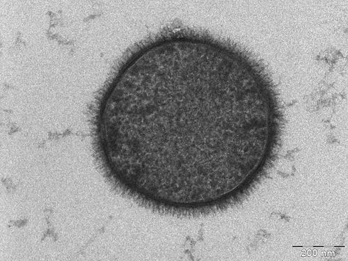Bacillus_subtilis.jpg