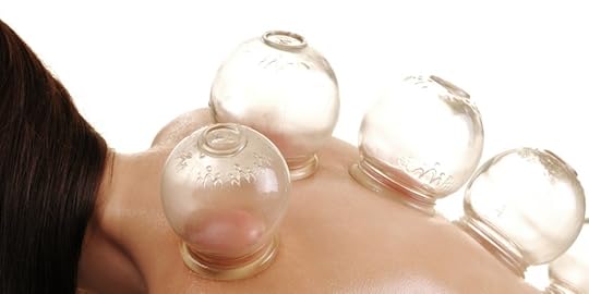 Cupping | Tracie Braylock