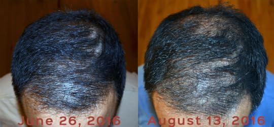 Before and After.