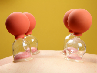 Cupping In-Line