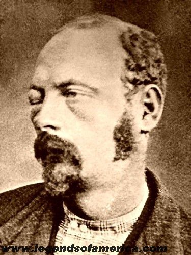 Cole Younger after being injured in the Northfield, Minnesota raid.