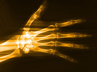Hand x-ray