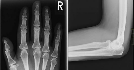 Body Nickname Origins