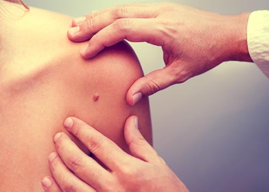 trusted_mole_check_clinic_in_australia