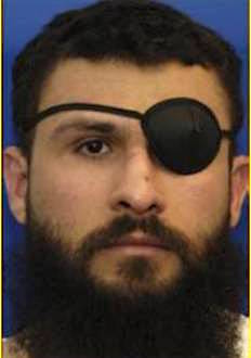 Abu Zubaydah at Guantanamo, in a photo included in the classified military files released by WikiLeaks in 2011. The eye patch covers his lost eye, removed in US custody.