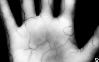 vein scan