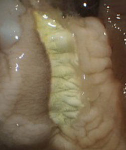 Hypobranchial gland, live Murex