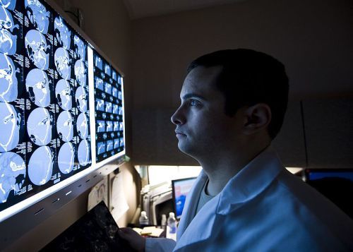 brain-scan