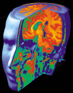 Left Brain