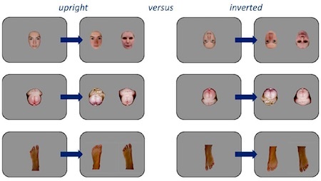bodyparts