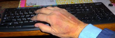 bruise